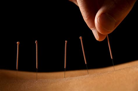 despite of its general safety acupuncture isn t for everyone